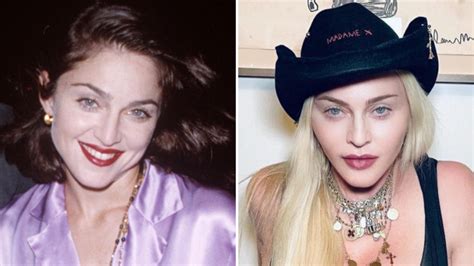 Madonna Plastic Surgery Facts! ? All About Her Operations