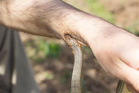 Snake Bite Pictures, Images and Stock Photos - iStock