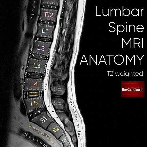 The Radiologist on Instagram: “Sagittal T2 weighted image of an MRI of ...