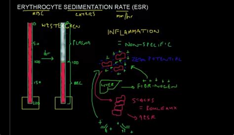 ESR Blood Test Results Explained - HRF