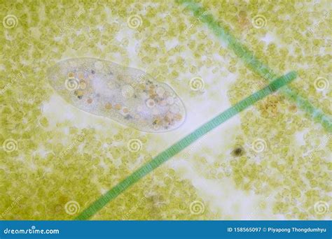 Frontonia Sp. Unicellular Ciliate Protists Under the Microscope. Stock ...