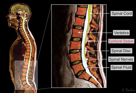 Lumbar Spine MRI | Mri Scan Images | Pain treatment, Anatomy, Mri