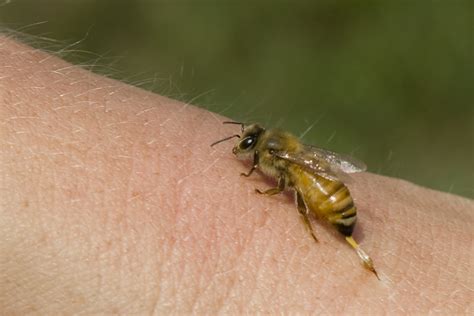 How bee venom helps to heal cancer | NaturalHealth365