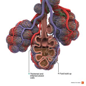 Alveoli - Physiopedia