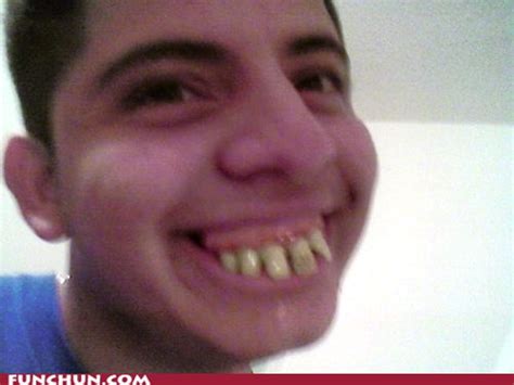 Funny teeth - Funny Pics and Videos