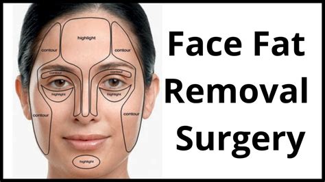 Face Fat Removal Surgery - Procedure, Cost, Candidates, Complications.