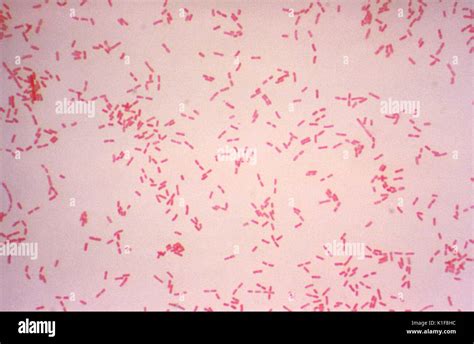 Alcaligenes Faecalis Gram Stain