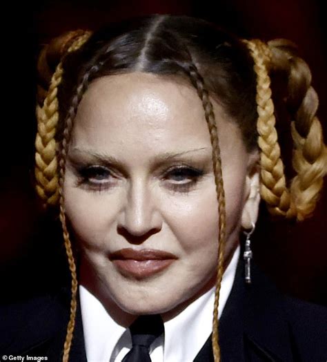 Singer Madonna admits to plastic surgery after her unrecognizable ...