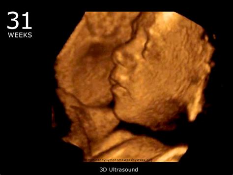 31 Week 3D Ultrasound Baby Picture | Pregnancy Symptoms Week by Week