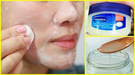 3 Days Overnight Pimples Treatment | World's best Pimple Treatment ...