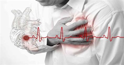 Angina pectoris or stable angina causes, symptoms, diagnosis & treatment