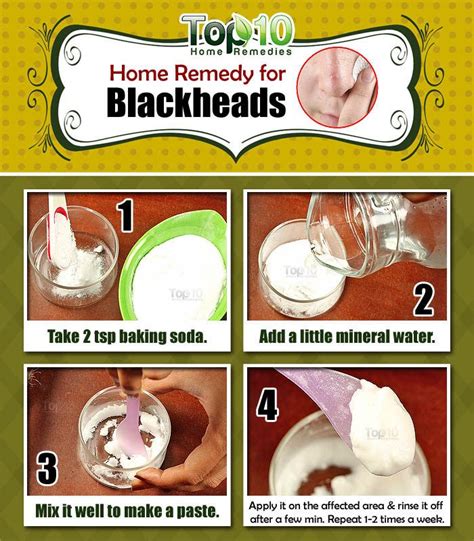 Home Remedies to Get Rid of Blackheads Fast | Top 10 Home Remedies