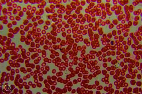 Under the Microscope: Red Blood Cells - Travis Hale (Photography and ...