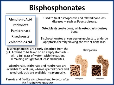 Bisphosphonates | Pharmacology, Pharmacology nursing, Nursing exam