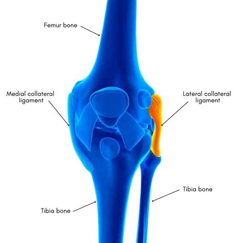 LCL Injury | Lateral Collateral Ligament Injury of the Knee