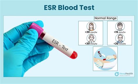 ESR Blood Test - Normal Range, Cost, Purpose & Result