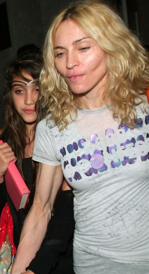 Celebrity Madonna - plastic surgery, photos, video