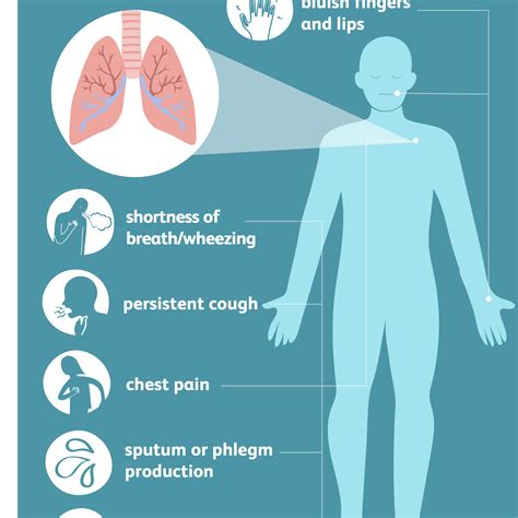 What Are The 4 Stages Of Emphysema - Maybe you would like to learn more ...