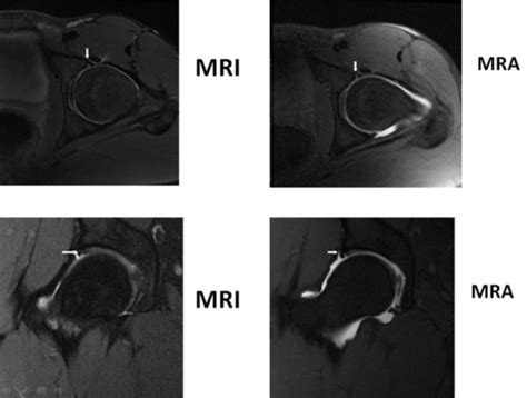 Med Imaging Final MRA vs MRI Flashcards | Quizlet