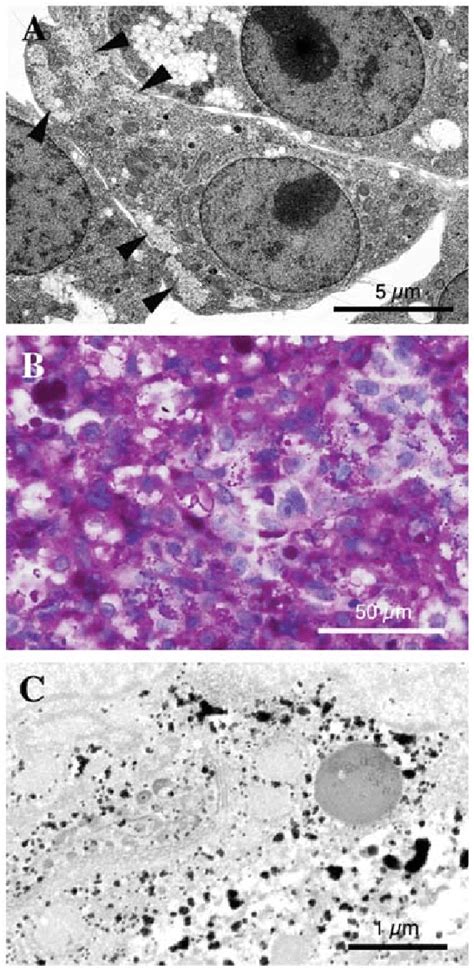 Detection of glycogen granules. (A) Transmission electron micrographs ...