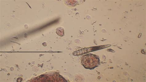 25 New Demodex Mites Under Microscope - Demodectic Mange