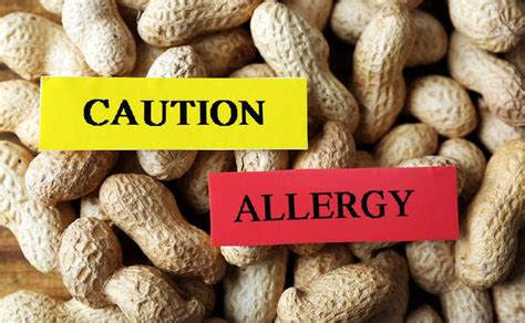 Facts About Peanut Allergy: Causes, Symptoms, and How to Manage It ...