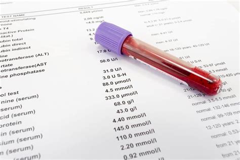 How to read your medical test report: Erythrocyte Sedimentation Rate ...