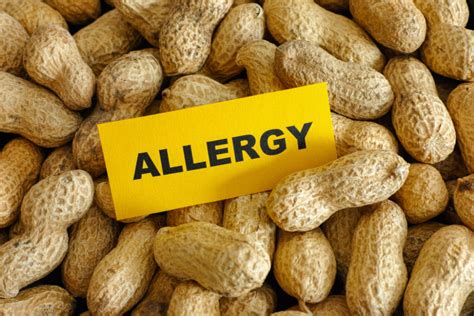 What Are Peanut Allergy Symptoms? | Food Allergies Atlanta