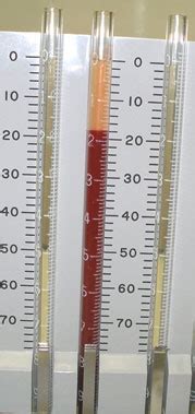 Erythrocyte Sedimentation Rate - ESR