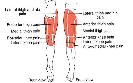 Hip, Thigh & Knee | The Trigger Point & Referred Pain Guide