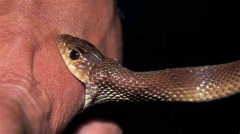 Snake Bite Treatment at Home: Quick Remedy Against Snake Bites