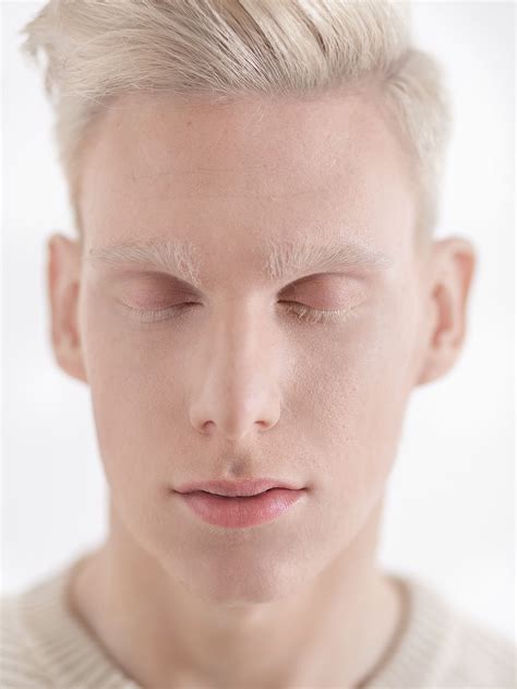 Albino model by Valeria Lokinskaya | Albino, Albino model, Albino men