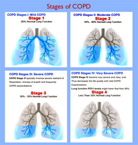 Stages of COPD | Respiratory therapy, Respiratory care, Chronic ...