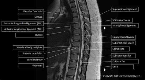 Approach To Mri Spine | Free Download Nude Photo Gallery