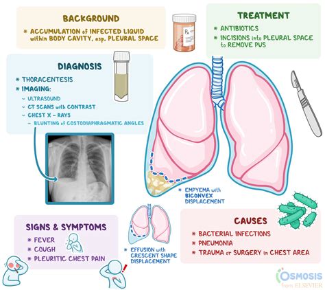 Empyema: What Is It, Causes, Treatment, and More | Osmosis