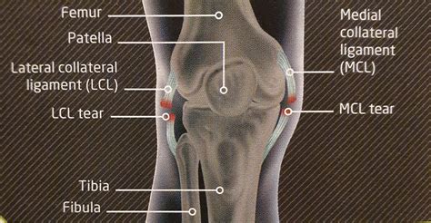 KNEE LIGAMENT INJURY | Klinique Pain Management & Wellbeing Clinic