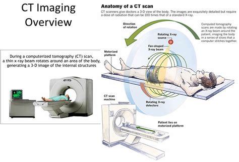 Circuit Diagram Of Ct Scan Machine