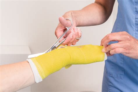 What to Expect Immediately After Cast Removal