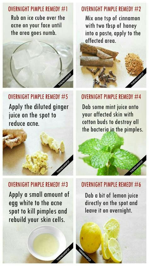 Overnight Pimple Remedies, Pimples Remedies, Pimples Overnight, Skin ...