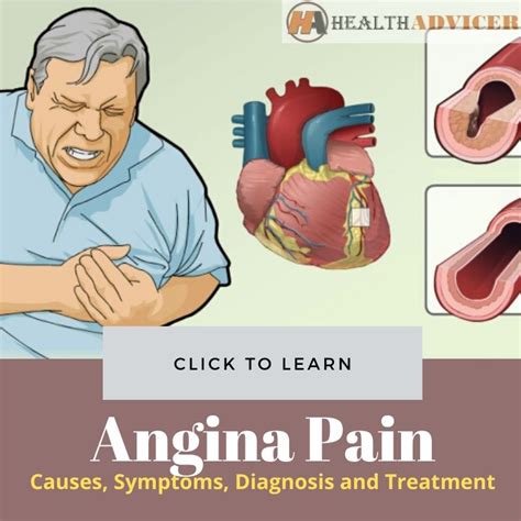 Angina