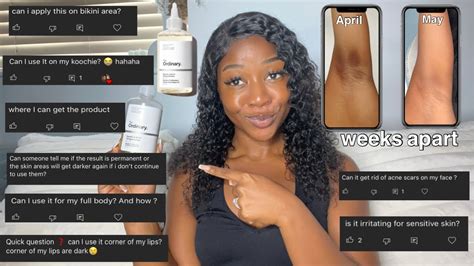 HOW TO USE GLYCOLIC ACID TONER FOR THE BEST RESULTS | answering your ...