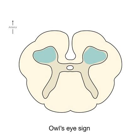 Owl Eyes Anatomy