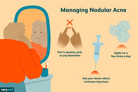 Blind Pimple Diagram - exatin.info