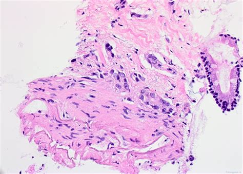 Digestive system cytology | Atlas of Pathology