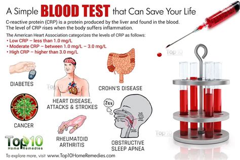 blood tests for infections - pictures, photos