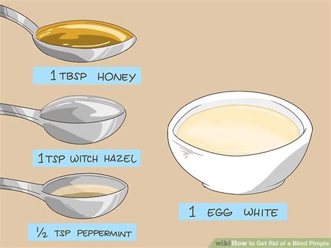 4 Ways to Get Rid of a Blind Pimple - wikiHow Life