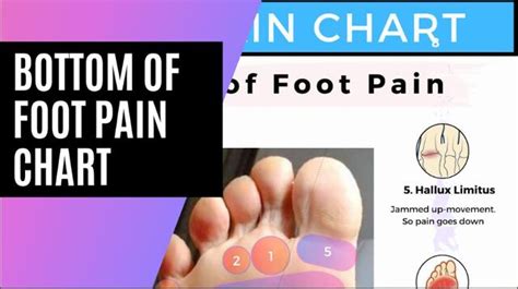 Foot Pain Diagnosis Diagram