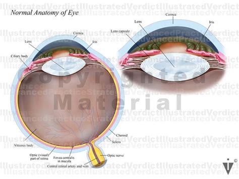 CASE AT A GLANCE: Corneal Perforation / Corneal Transplant ...