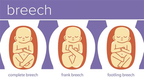 Baby Positions in Womb: What They Mean