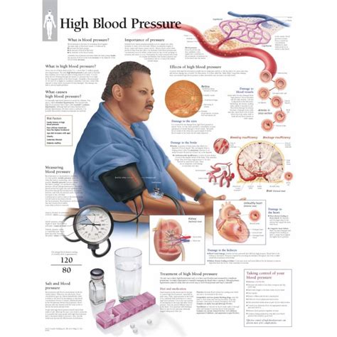 Scientific Publishing High Blood Pressure Chart